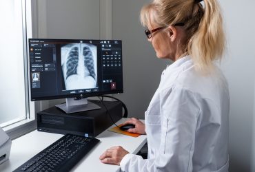 Lääkäri tutkimassa tietokoneen ruudulla näkyvää mustavalkoista kuvaa keuhkoista.