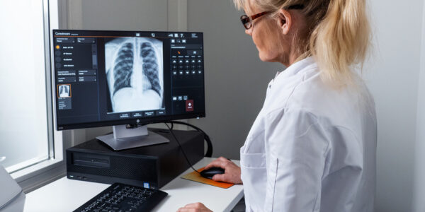 Lääkäri tutkimassa tietokoneen ruudulla näkyvää mustavalkoista kuvaa keuhkoista.