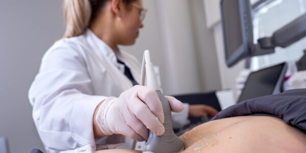 Lääkäri ultraamassa asiakkaan vatsaa, lähikuva.